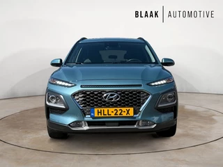Hyundai Kona - afbeelding nr 16