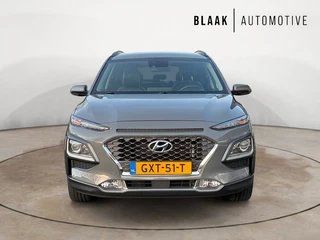 Hyundai Kona - afbeelding nr 16