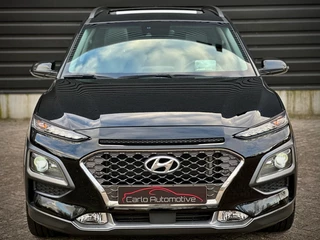 Hyundai Kona - afbeelding nr 36