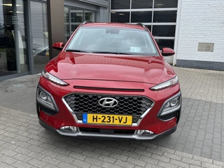 Hyundai Kona - afbeelding nr 3